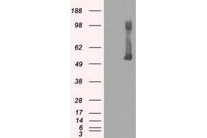 Image no. 2 for anti-Glucokinase (Hexokinase 4) (GCK) antibody (ABIN1498413) (GCK anticorps)
