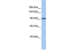 WB Suggested Anti-ZNF295 Antibody Titration:  0. (ZNF295 anticorps  (N-Term))