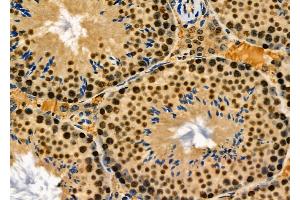 NUCL Antibody at 1/100 staining Mouse lung tissue by IHC-P. (Nucleolin anticorps  (Internal Region))