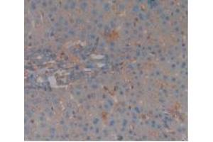 IHC-P analysis of Rat Liver Tissue, with DAB staining. (Complement Factor H anticorps  (AA 975-1217))