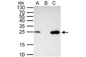 IP Image mtTFA antibody immunoprecipitates mtTFA protein in IP experiments.