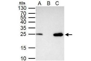 IP Image mtTFA antibody immunoprecipitates mtTFA protein in IP experiments. (TFAM anticorps)
