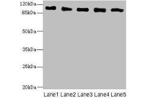 Western blot All lanes: COPB2 antibody at 2. (COPB2 anticorps  (AA 657-906))