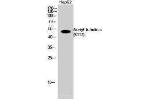 Western Blotting (WB) image for anti-alpha Tubulin (TUBA1) (acLys112) antibody (ABIN3179379) (alpha Tubulin anticorps  (acLys112))