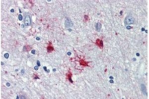 Human Brain, cortex: Formalin-Fixed, Paraffin-Embedded (FFPE) (alpha 1 Adrenergic Receptor anticorps  (AA 206-270))