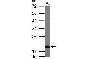 NDUFS4 anticorps  (Center)