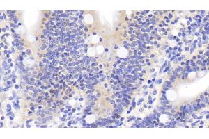 Detection of DTYMK in Human Small intestine Tissue using Polyclonal Antibody to Deoxythymidylate Kinase (DTYMK)
