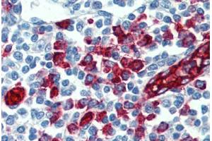 Human Tonsil: Formalin-Fixed, Paraffin-Embedded (FFPE) (SELPLG anticorps)