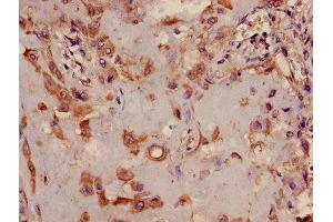 Immunohistochemistry of paraffin-embedded human placenta tissue using ABIN7173361 at dilution of 1:100 (TRIB2 anticorps  (AA 204-337))