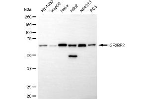 Western blotting analysis using IGF2BP2 antibody (ABIN7799051). (Recombinant IGF2BP2 anticorps)