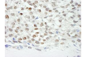 Immunohistochemistry (IHC) image for anti-Zinc Finger Protein 318 (Znf318) (AA 2049-2099) antibody (ABIN7449041) (ZNF318 anticorps  (AA 2049-2099))