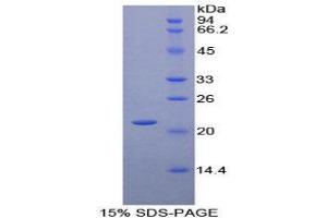 SDS-PAGE (SDS) image for CD8b Molecule (CD8B) (AA 22-170) protein (His tag) (ABIN1879128)