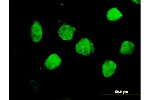 Immunofluorescence of purified MaxPab antibody to TLE1 on HeLa cell.