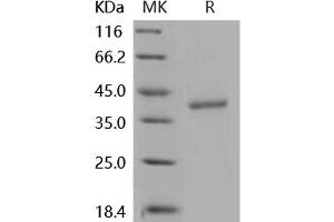 Western Blotting (WB) image for Cathepsin Z (CTSZ) (Active) protein (His tag) (ABIN7194694)