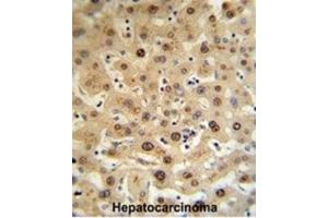Immunohistochemistry (IHC) image for anti-Hemopexin (HPX) antibody (ABIN3002733) (Hemopexin anticorps)