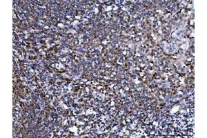 IHC analysis of SPT5/SUPT5H using anti-SPT5/SUPT5H antibody (ABIN7601985). (SUPT5H anticorps  (AA 533-1087))