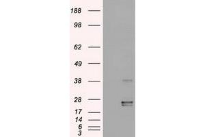 HEK293T cells were transfected with the pCMV6-ENTRY control (Left lane) or pCMV6-ENTRY OSM (Right lane) cDNA for 48 hrs and lysed. (Oncostatin M anticorps  (AA 25-252))