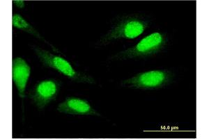Immunofluorescence of monoclonal antibody to MNDA on HeLa cell. (MNDA anticorps  (AA 311-407))