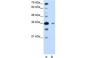 WB Suggested Anti-DAZAP1 Antibody Titration:  0. (DAZAP1 anticorps  (C-Term))