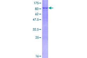 Image no. 1 for Monoamine Oxidase A (MAOA) (AA 1-527) protein (GST tag) (ABIN1310148)