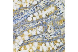 Immunohistochemistry of paraffin-embedded rat intestine using PGK1 Antibody.
