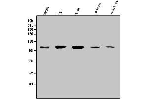 Western blot analysis of SEZ6L using anti-SEZ6L antibody (ABIN7602260). (SEZ6L anticorps  (AA 662-953))