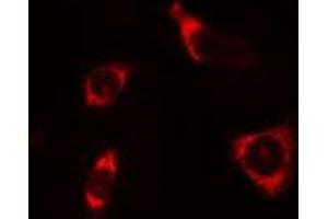 ABIN6268871 staining HeLa cells by IF/ICC.