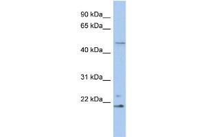 WB Suggested Anti-RBBP9 Antibody Titration:  0.