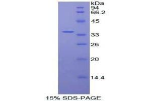 SDS-PAGE analysis of Human Protein Kinase B beta Protein. (AKT2 Protéine)