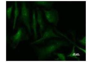 Immunostaining analysis in HeLa cells.