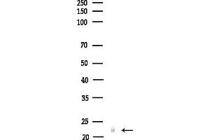 anti-Interferon, alpha 6 (IFNA6) (C-Term) antibody