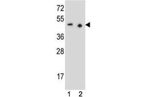 PAX9 antibody western blot analysis in (1) 293 and (2) Jurkat lysate (PAX9 anticorps  (AA 69-95))