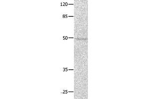 Western blot analysis of Jurkat cell, using NAP1L1 Polyclonal Antibody at dilution of 1:650
