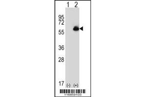 Western blot analysis of ALDH4A1 using rabbit polyclonal ALDH4A1 Antibody using 293 cell lysates (2 ug/lane) either nontransfected (Lane 1) or transiently transfected (Lane 2) with the ALDH4A1 gene. (ALDH4A1 anticorps  (C-Term))