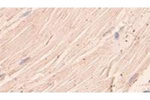 Immunohistochemical staining of formalin-fixed paraffin-embedded human skeletal muscle showing staining with ANGPTL1 polyclonal antibody  at 1:100 dilution.