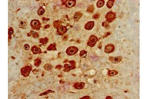 Immunohistochemistry of paraffin-embedded human placenta tissue using ABIN7156860 at dilution of 1:100