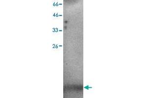 Western blot analysis of H520 whole cell lystae with C3orf10 monoclonal antibody, clone 37  at 1:500 dilution. (BRK1 anticorps)
