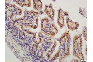 Formalin-fixed and paraffin embedded mouse intestine labeled with Rabbit Anti-HMGCR(Ser872) Polyclonal Antibody, Unconjugated  at 1:200 followed by conjugation to the secondary antibody and DAB staining