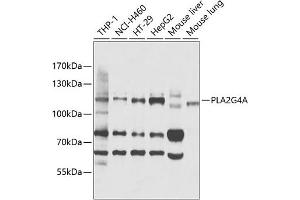 Western blot analysis of extracts of various cell lines, using PLG4A antibody (ABIN3020970, ABIN3020971, ABIN3020972 and ABIN6213833) at 1:1000 dilution. (PLA2G4A anticorps  (AA 1-180))