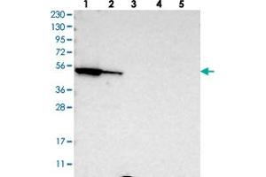 Western blot analysis of Lane 1: RT-4, Lane 2: U-251 MG, Lane 3: Human Plasma, Lane 4: Liver, Lane 5: Tonsil with FAR1 polyclonal antibody . (FAR1 anticorps)