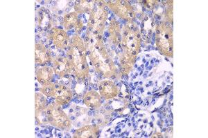Immunohistochemistry of paraffin-embedded rat kidney using RPS6KB1 antibody at dilution of 1:100 (400x lens). (RPS6KB1 anticorps)