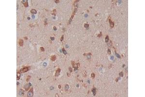 Used in DAB staining on fromalin fixed paraffin- embedded brain tissue