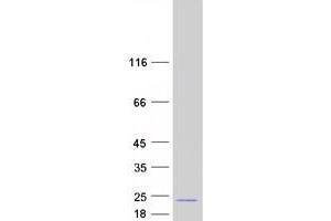 Validation with Western Blot