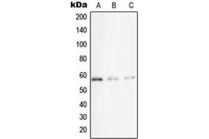 Western blot analysis of STK33 expression in A431 (A), Jurkat (B), HeLa (C) whole cell lysates. (STK33 anticorps  (N-Term))