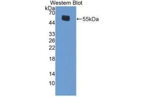 Detection of Recombinant ERb, Mouse using Polyclonal Antibody to Estrogen Receptor Beta (ERb) (ESR2 anticorps  (AA 46-530))