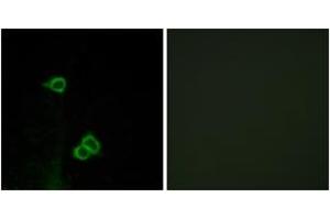 Immunofluorescence analysis of COS7 cells, using CXCR7 Antibody. (CXCR7 anticorps  (AA 311-360))