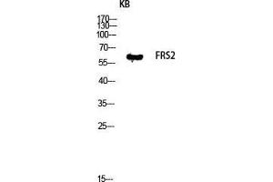 Western Blot (WB) analysis of KB lysis using FRS2 antibody. (FRS2 anticorps  (Tyr580))