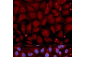 Immunofluorescence analysis of U2OS cells using BCHE Polyclonal Antibody (Butyrylcholinesterase anticorps)