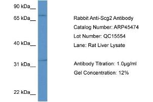 Western Blotting (WB) image for anti-Secretogranin II (SCG2) (Middle Region) antibody (ABIN2782232) (SCG2 anticorps  (Middle Region))