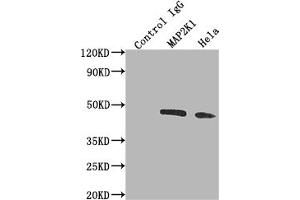 Immunoprecipitating MAP2K1 in Hela whole cell lysate Lane 1: Rabbit control IgG instead of ABIN7127612 in Hela whole cell lysate. (Recombinant MEK1 anticorps)